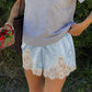 🩳 50% OFF NOW! ✨ Satin Lace Trim Shorts – Effortless Summer Chic – Soft, breathable & perfect for lounging or beach-to-bar looks 🌿