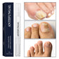 🦶 50% OFF NOW! ✨ Toenail Fungus Treatment Pen – Fast-acting & easy to apply – Targets damaged nails, helps restore healthy appearance – perfect for daily use at home 🩹💪