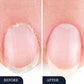 🦶 50% OFF NOW! ✨ Toenail Fungus Treatment Pen – Fast-acting & easy to apply – Targets damaged nails, helps restore healthy appearance – perfect for daily use at home 🩹💪